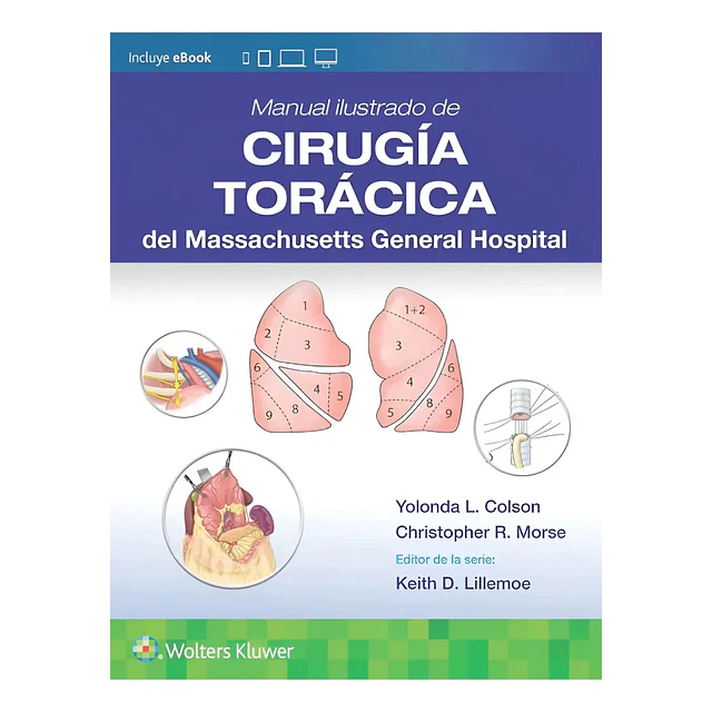Manual ilustrado de Cirugía torácica del Massachusetts General Hospital