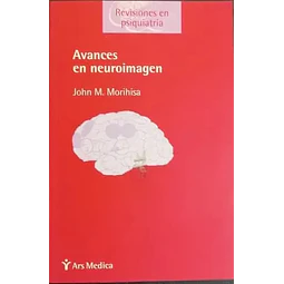 Avances en neuroimagen