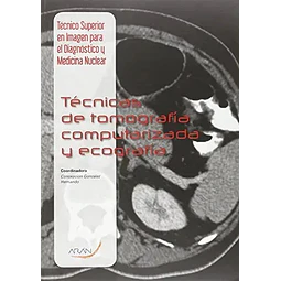 Técnicas de tomografía computarizada y ecografía
