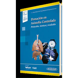 Donación en Asistolia Controlada