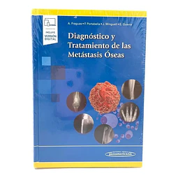 Diagnóstico y Tratamiento de las Metástasis Óseas