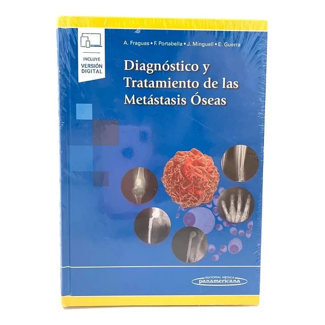 Diagnóstico y Tratamiento de las Metástasis Óseas
