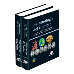 Imagenología del cerebro - 2 Tomos