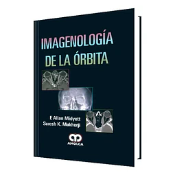 Imagenología de la órbita