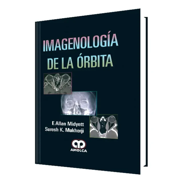 Imagenología de la órbita