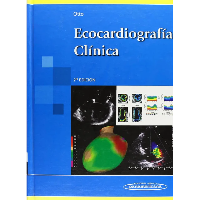 Ecocardiografía clínica