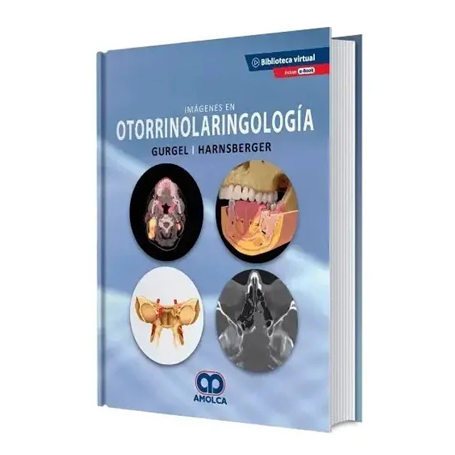 Imágenes en Otorrinolaringología