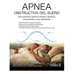 Apnea Obstructiva del Sueño