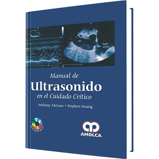 Manual de Ultrasonido en el Cuidado Crítico