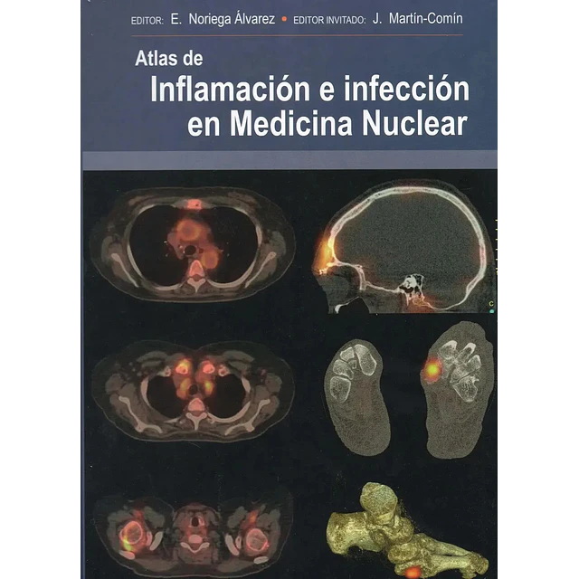 Atlas de Inflamación en Infección en Medicina Nuclear