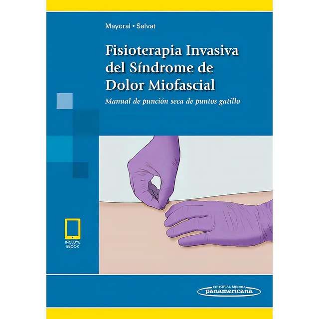 Fisioterapia Invasiva del Síndrome de Dolor Miofascial