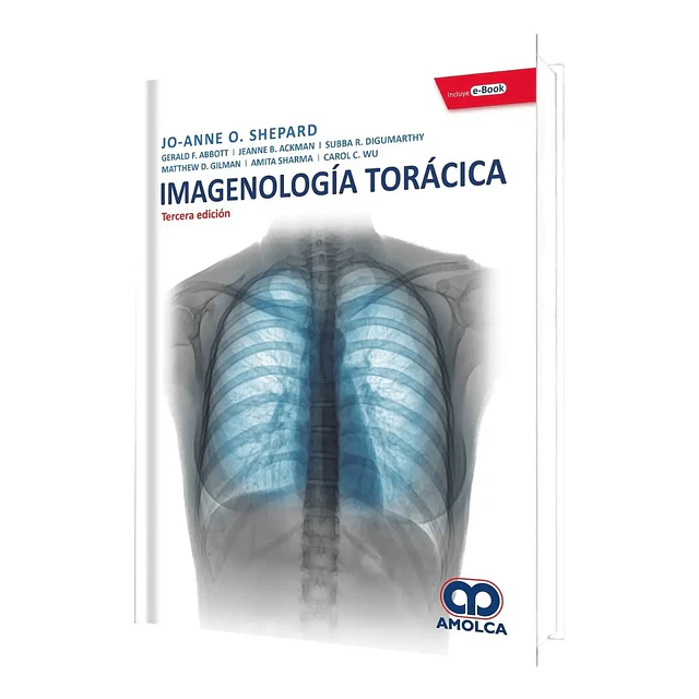 Imagenología Torácica