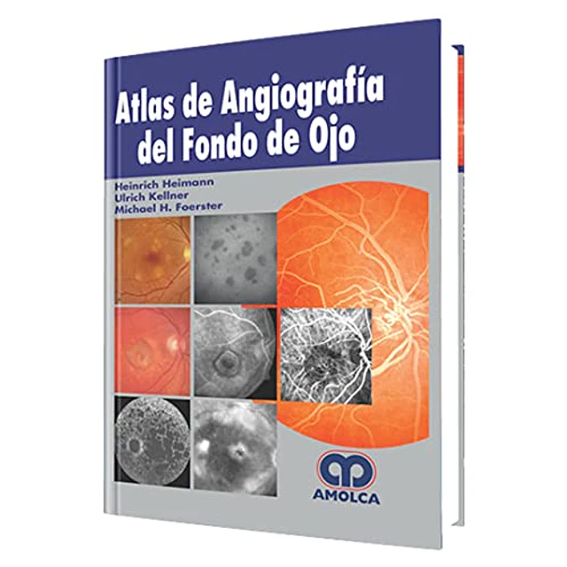 Atlas de angiografÍa del Fondo de Ojo