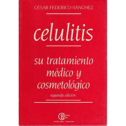 Celulitis