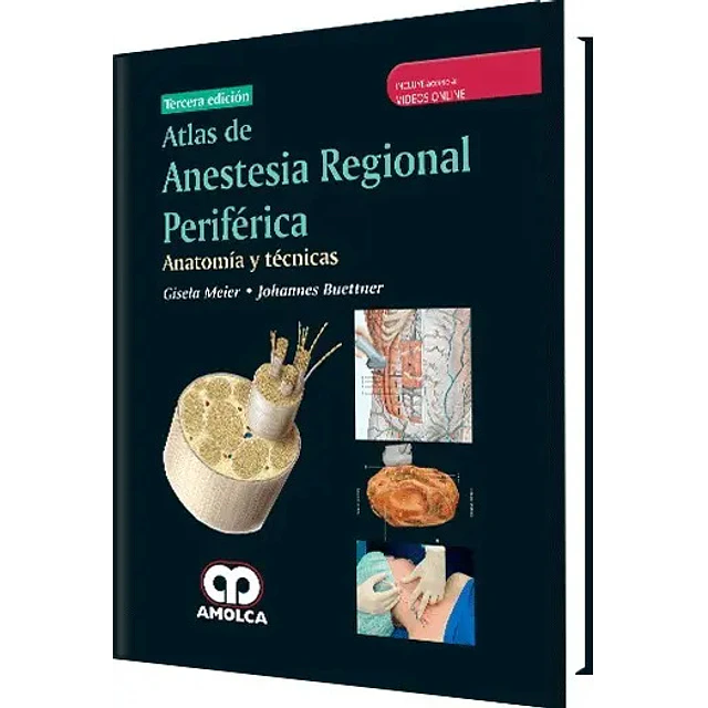 Atlas de Anestesia Regional Periférica