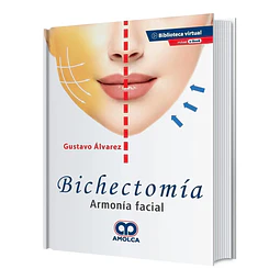 Bichectomía