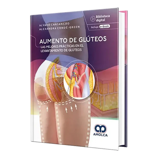 Aumento de glúteos