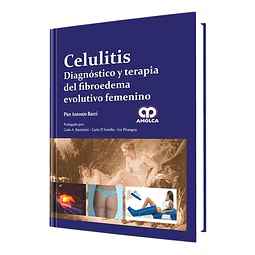 Celulitis