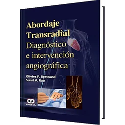 Abordaje Transradial