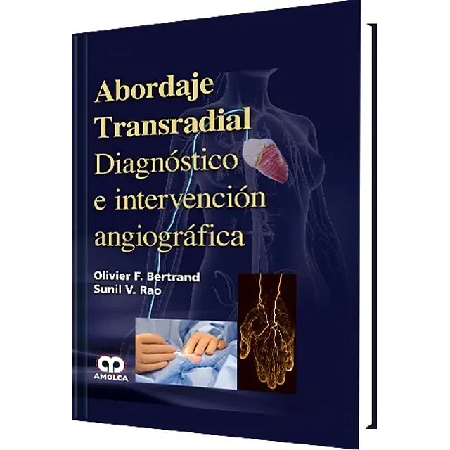 Abordaje Transradial