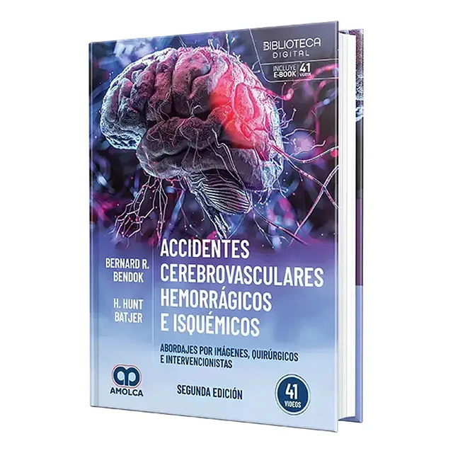 Accidentes cerebrovasculares hemorrágicos e isquémicos