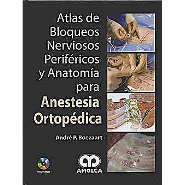 Anestesia Ortopédica atlas de Bloqueos Nerviosos Periféricos y anatomía para