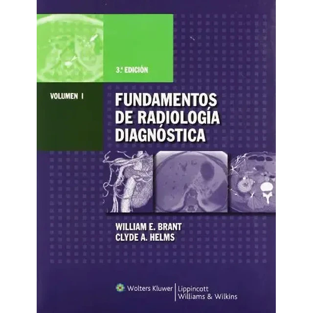 Fundamentos de Radiología Diagnóstica - 4 Tomos