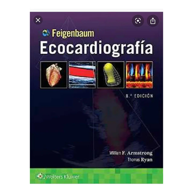 Ecocardiografía Feigenbaum