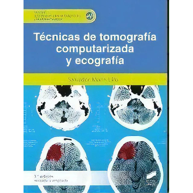 Técnicas de tomografía computarizada y ecografía