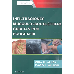 Infiltraciones musculoesqueléticas guiadas por ecografía
