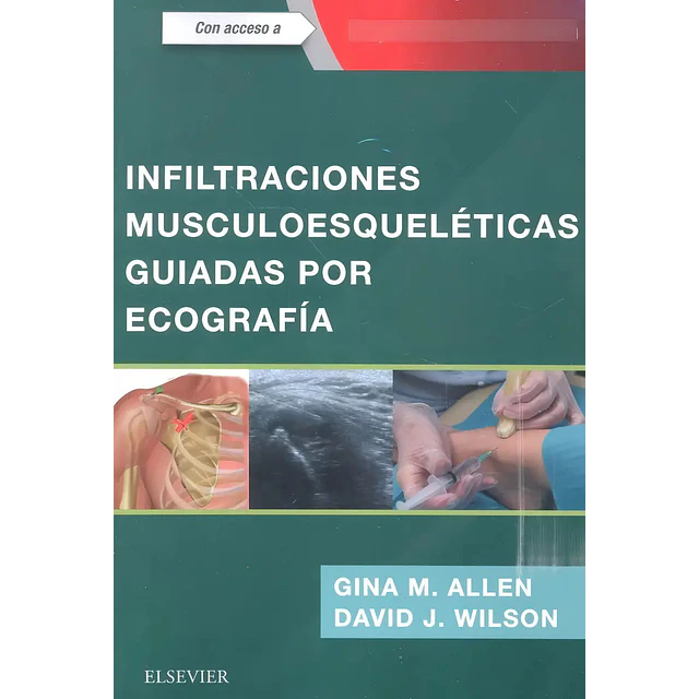Infiltraciones musculoesqueléticas guiadas por ecografía