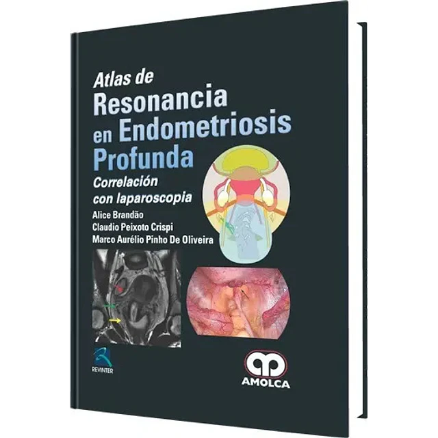 Atlas de Resonancia en Endometriosis Profunda