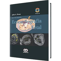 Ecocardiografía Fetal