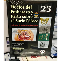 Efectos del embarazo y parto sobre el suelo pélvico