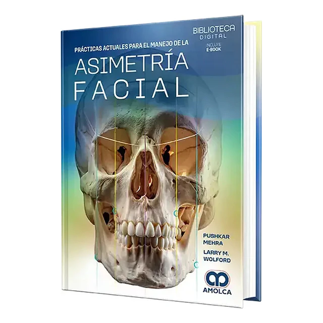 Prácticas actuales para el manejo de la asimetría facial