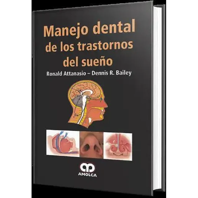 Manejo dental de los trastornos del sueño