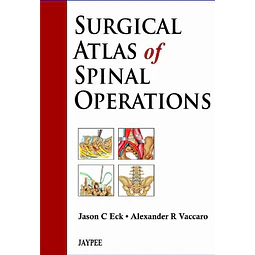Surgical Atlas of Spinal Operations