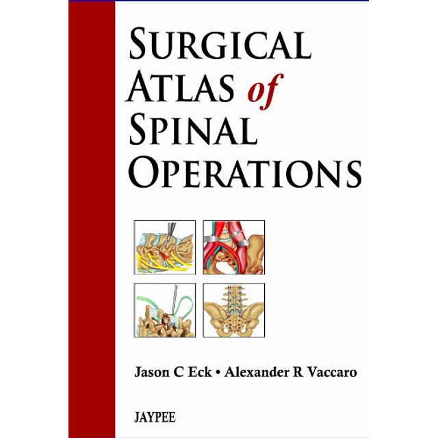 Surgical Atlas of Spinal Operations