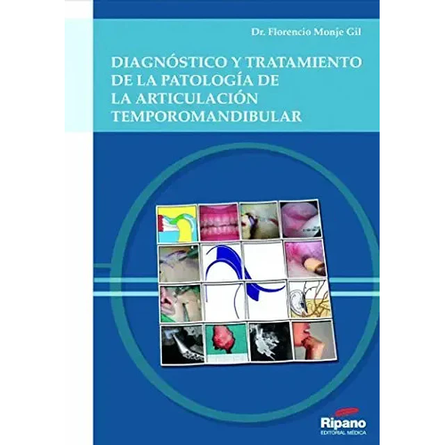 Diagnostico y tratamiento de la patologia de la articulacion temporomandibular