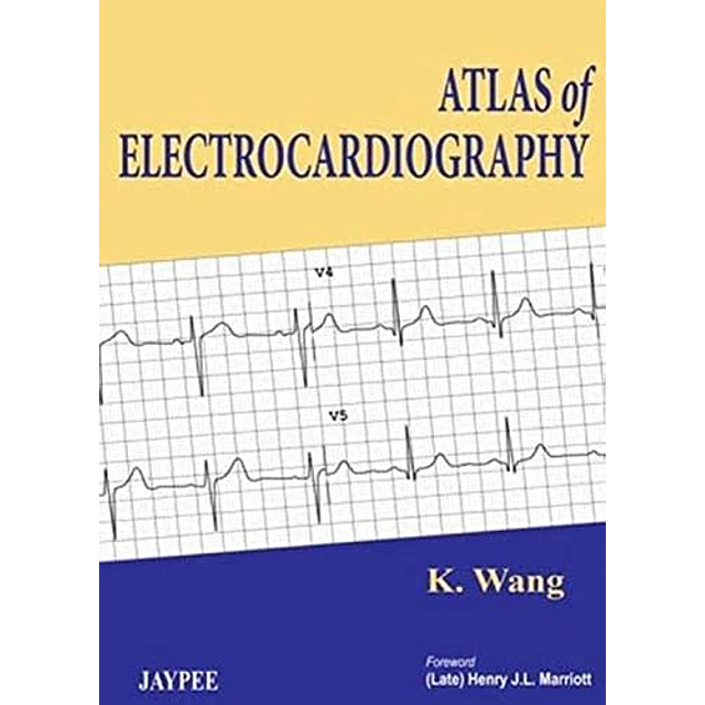 Atlas of Electrocardiography