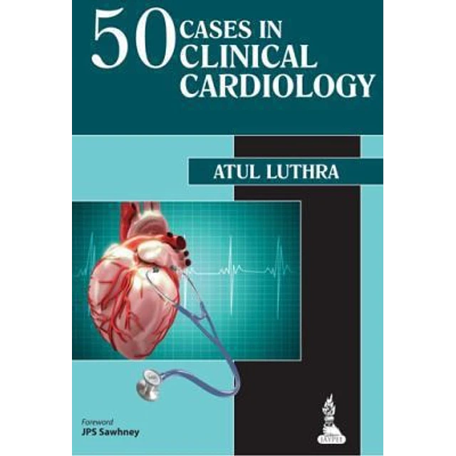 50 Cases in clinical cardiology