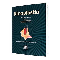 Rinoplastia