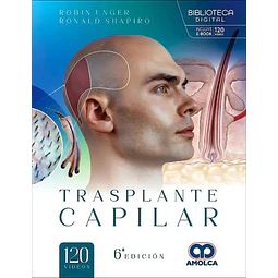 Trasplante capilar