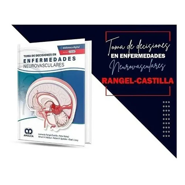 Toma de Decisiones en Enfermedades Neurovasculares