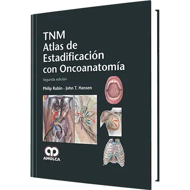 TNM Atlas de Estadificación con Oncoanatomía