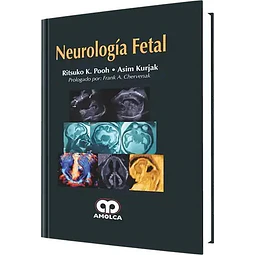 Neurología Fetal