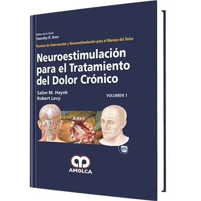 Neuroestimulación para el Tratamiento del Dolor Crónico - Volumen 1