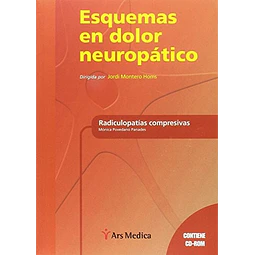 Esquemas de Dolor Neuropático