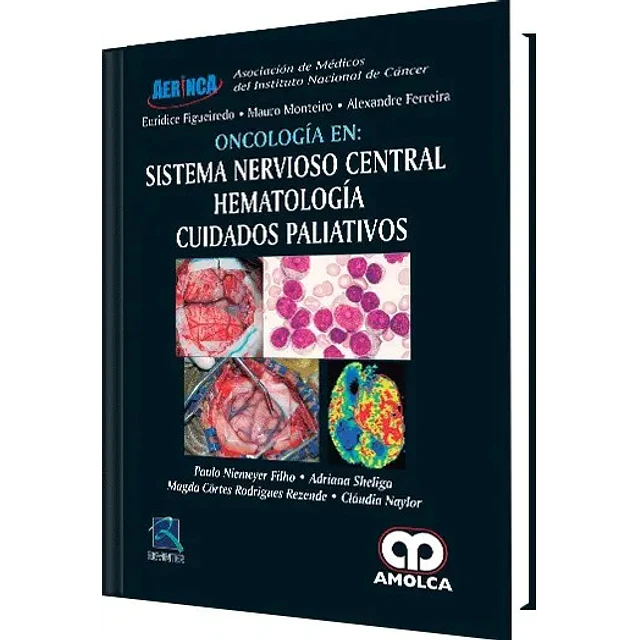 Oncología en : Sistema Nervioso Central Hematología Cuidados Palaitivos