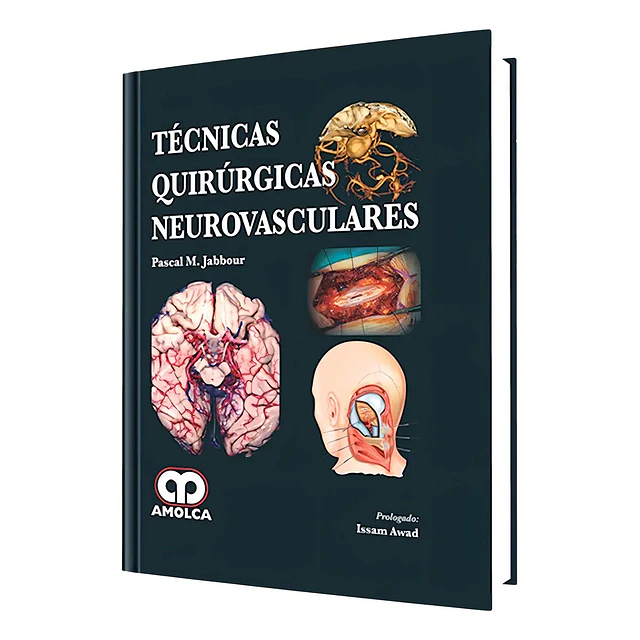 Técnicas Quirúrgicas Neurovasculares